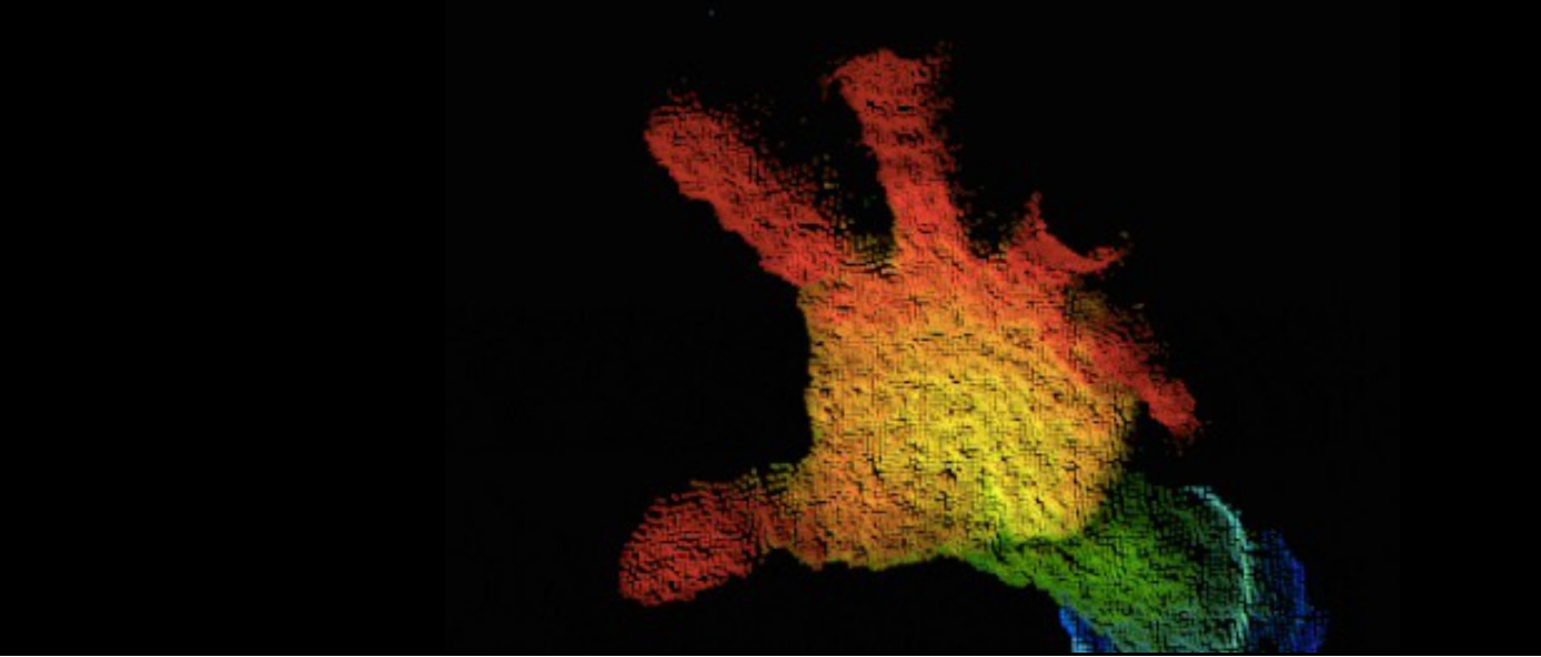 国产之光 | 澳银Family突破国外技术围堵，实现国产医疗平替